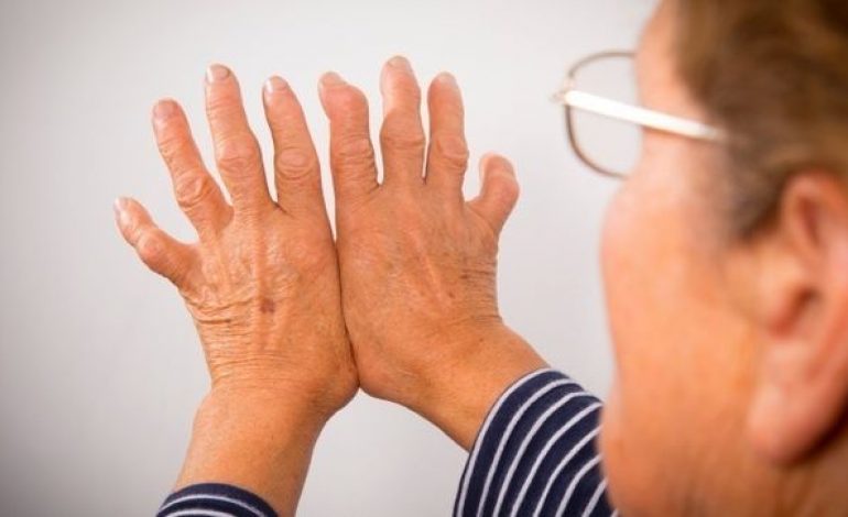 Médicos atenderán consultas de los ciudadanos sobre enfermedades reumáticas en Reumasalud 2019
