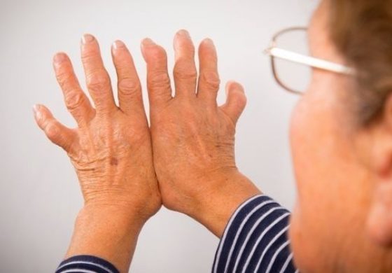 Médicos atenderán consultas de los ciudadanos sobre enfermedades reumáticas en Reumasalud 2019